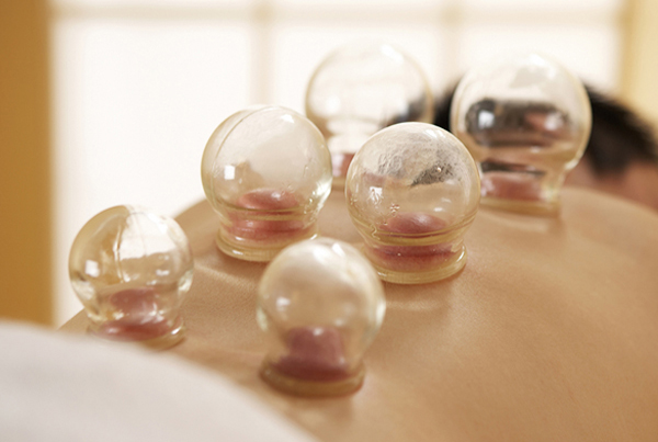 Cupping therapy