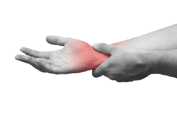Tenosynovitis