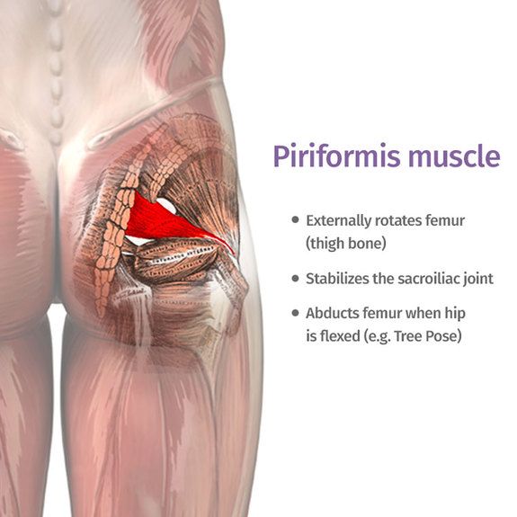 Piriformis Syndrome Treatment