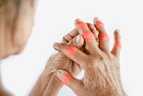 Rheumatoid Physiotherapy Treatment
