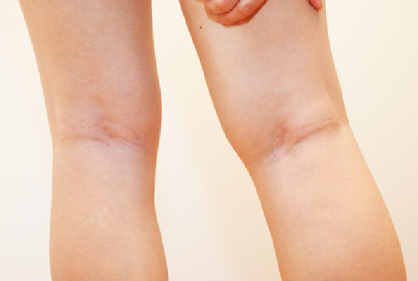 Bone Alignment Therapy